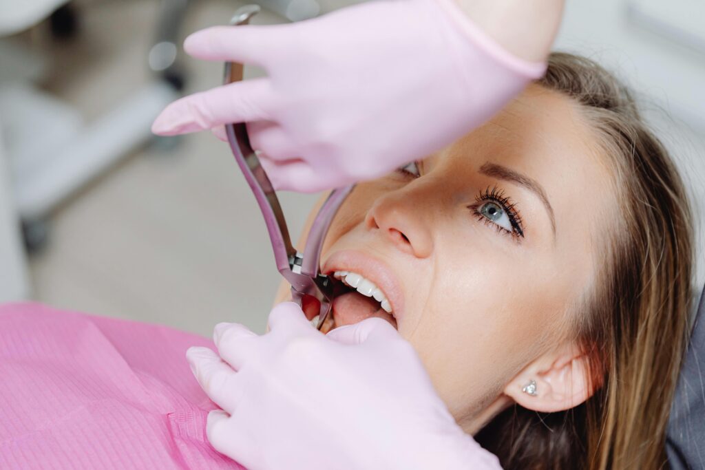 Tratamientos dentales: tipos, procedimientos y cuándo son necesarios
